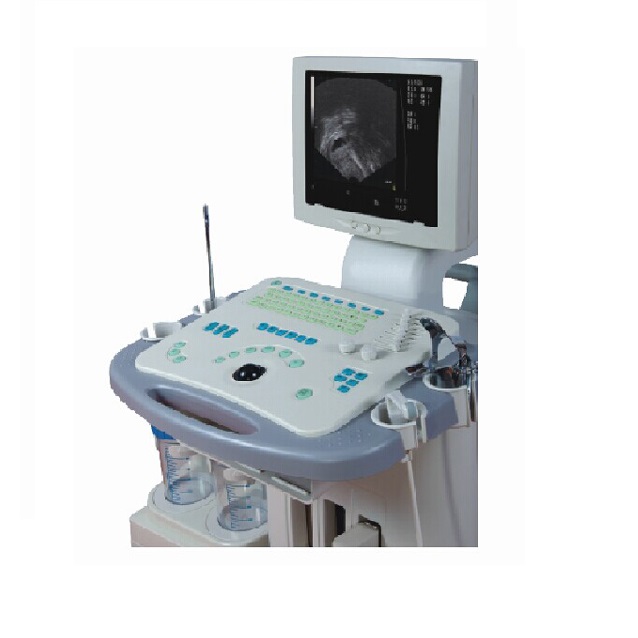 Máquina de sistema de diagnóstico ultrasónico visible Gyn aprobada por CE/ISO (MT01006081)